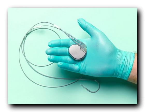 имплантируемый дефибриллятор (ИКД) | Implantable Cardioverter Defibrillators 